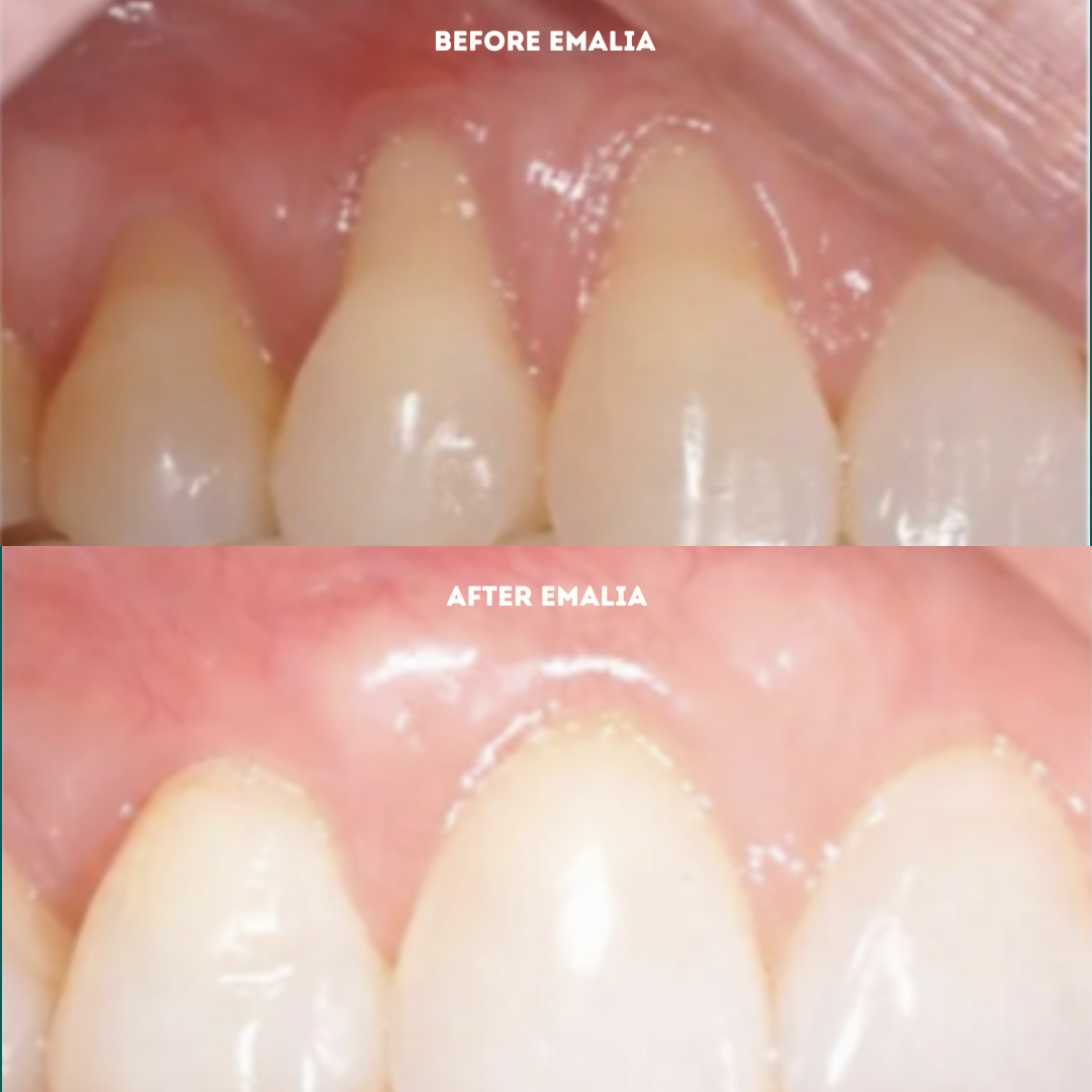 Enamel Tooth Powder - The Gentle Gum + Enamel Support Ritual