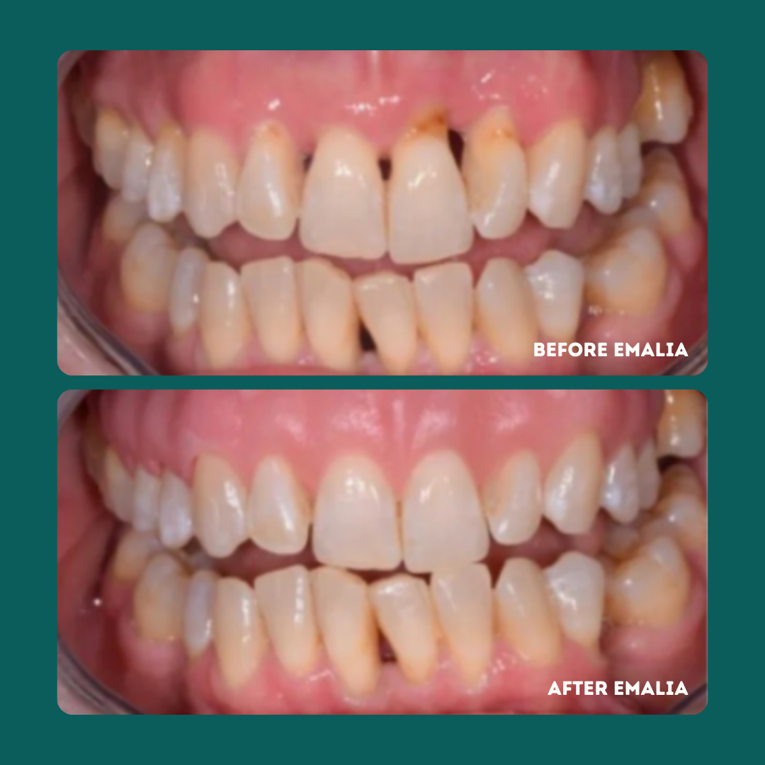 Enamel Tooth Powder - The Gentle Gum + Enamel Support Ritual